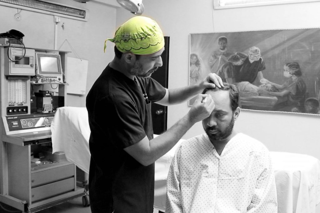 Hair-Transplant-scaled