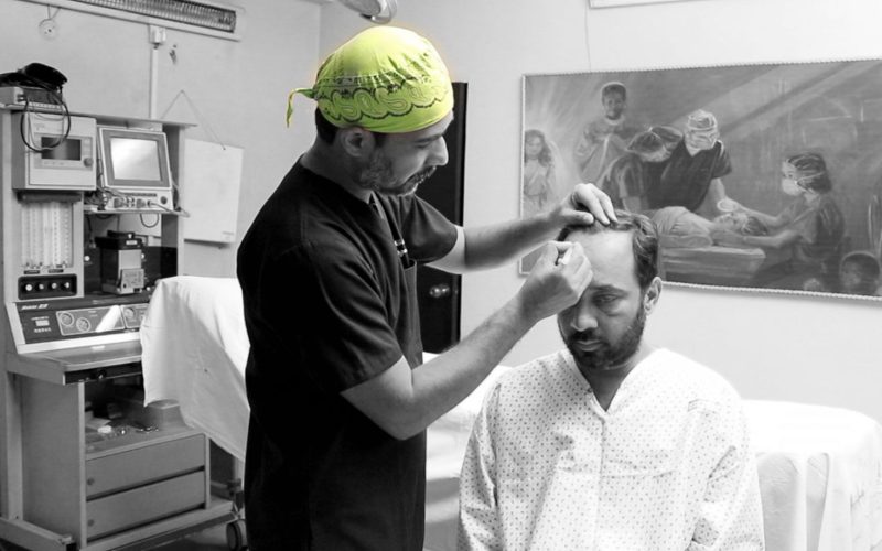 Hair-Transplant-scaled